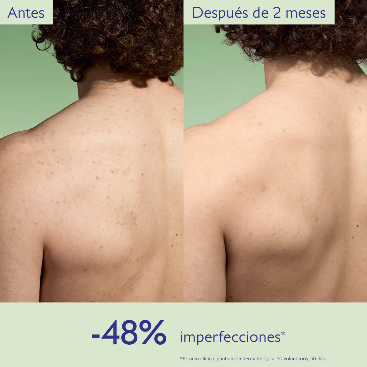 Caudalie Vinopure Tónico Purificante con Acido Salicílico - 200mL - Imagen 4