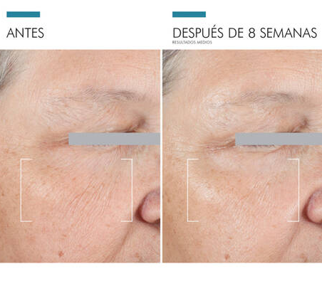 Skinceuticals A.G.E Advanced Eye Crema Antiojeras 15 ml - Imagen 4