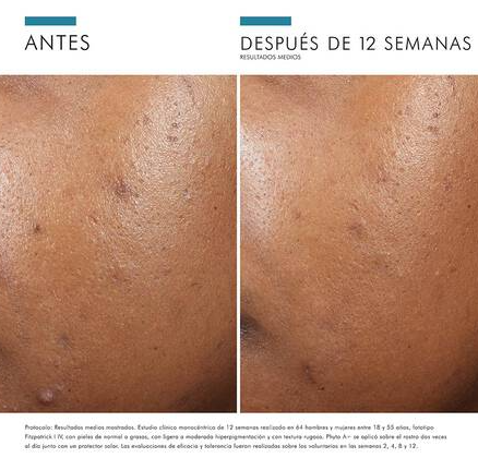 Skinceuticals Phyto A+ Brightening Treatment 30 ml - Imagen 4