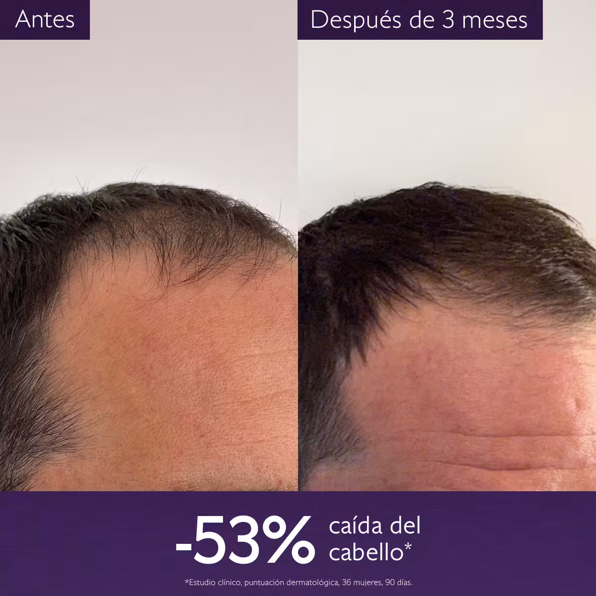 Caudalie Sérum Capilar Anticaída - Imagen 5