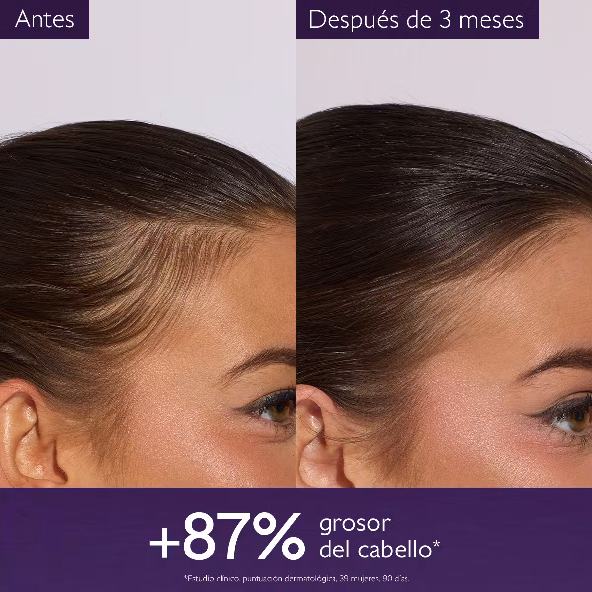 Caudalie Sérum Capilar Anticaída - Imagen 4